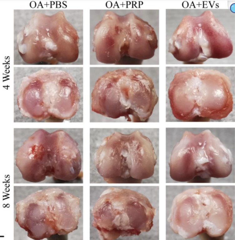 İnsan Göbek Kordonu Mezenkimal Kök Hücrelerinden Elde Edilen Eksozomların Osteoartrit Üzerindeki Anti-inflamatuar ve İmmünomodülatör Etkileri